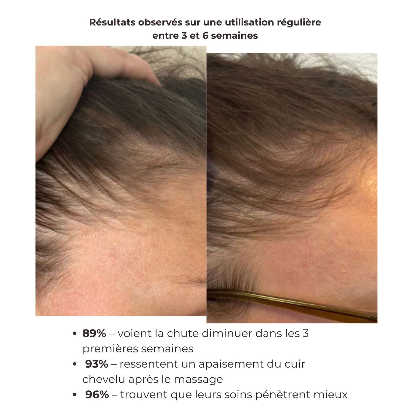 Le Rolly - Brosse massante applicatrice de soins - Roilon